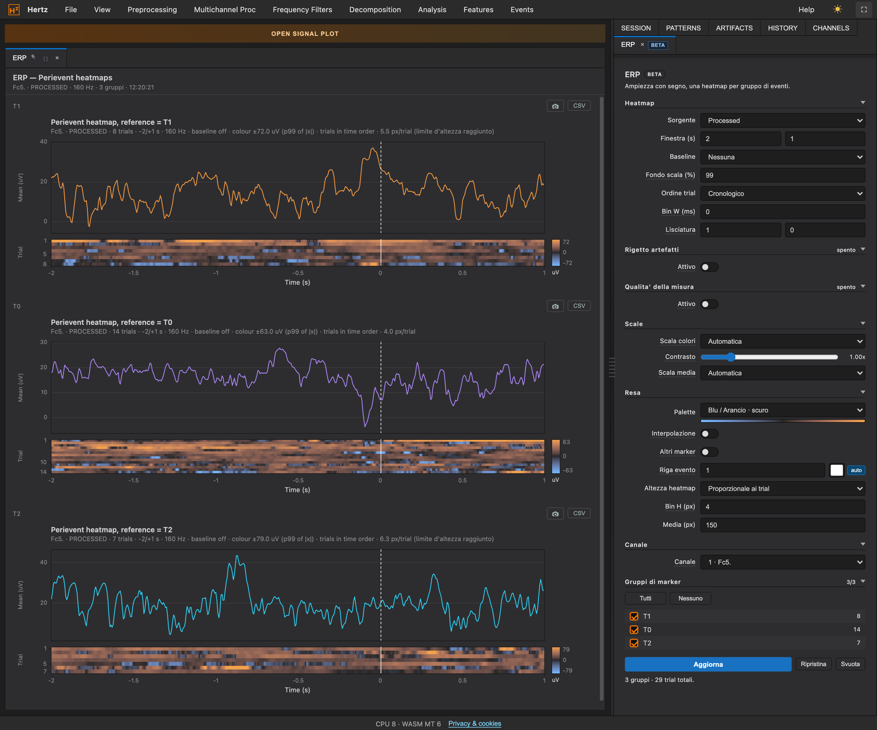 Peri-event ERP with trial heatmap