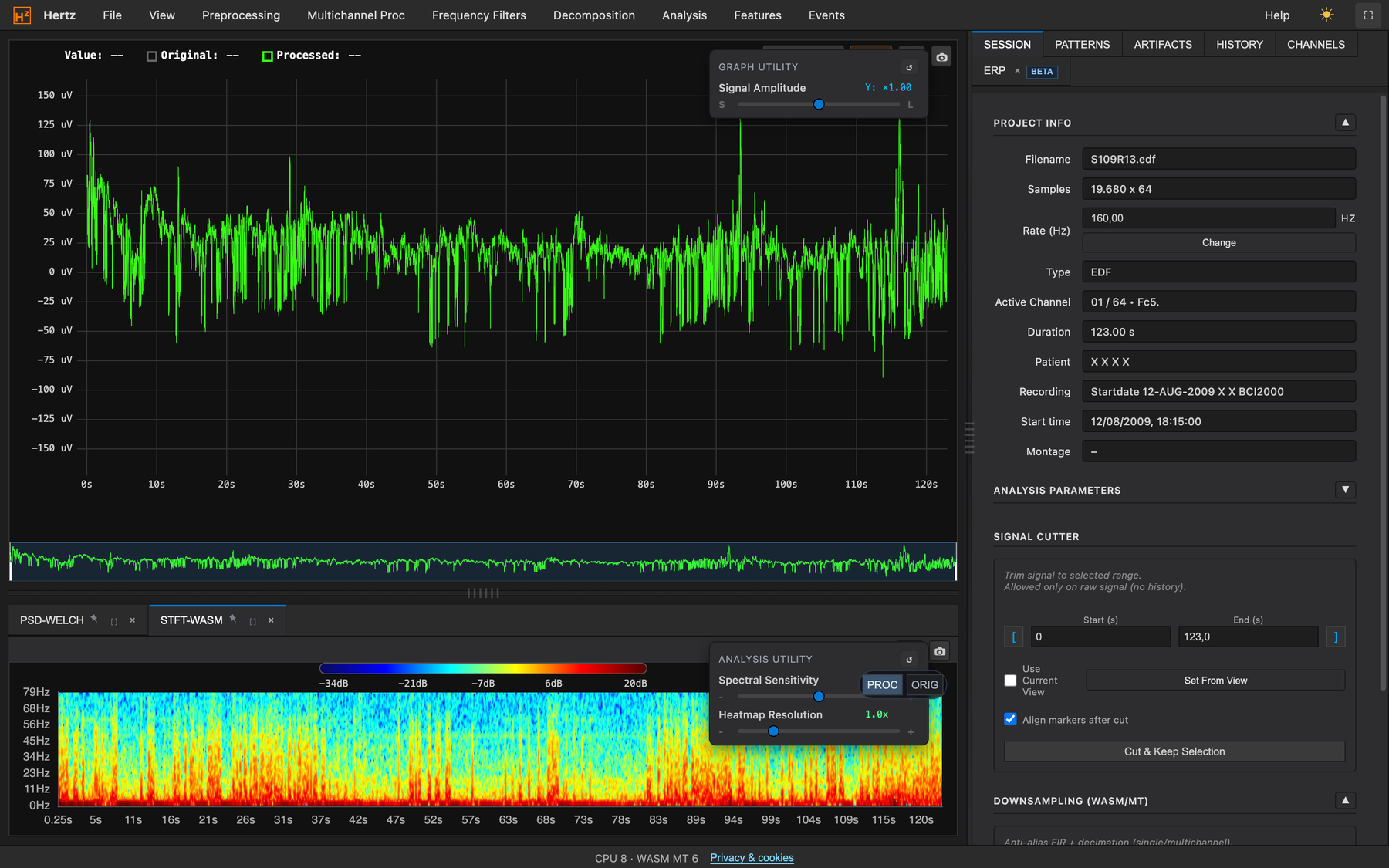 STFT spectrogram